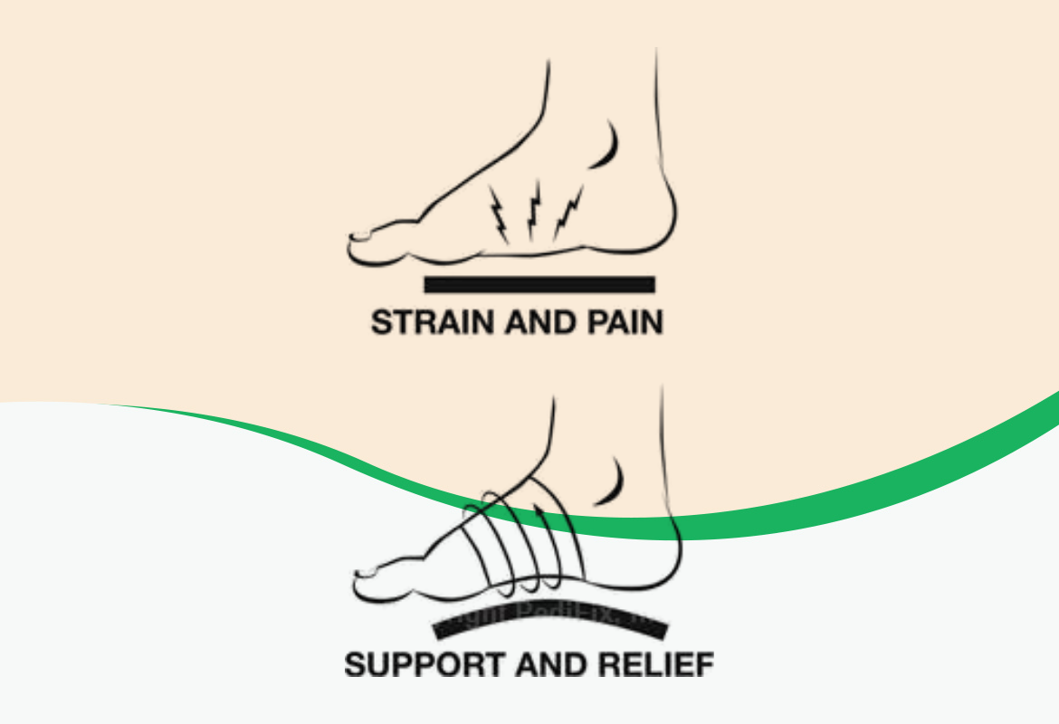 PediFix Arch Foot Bandage